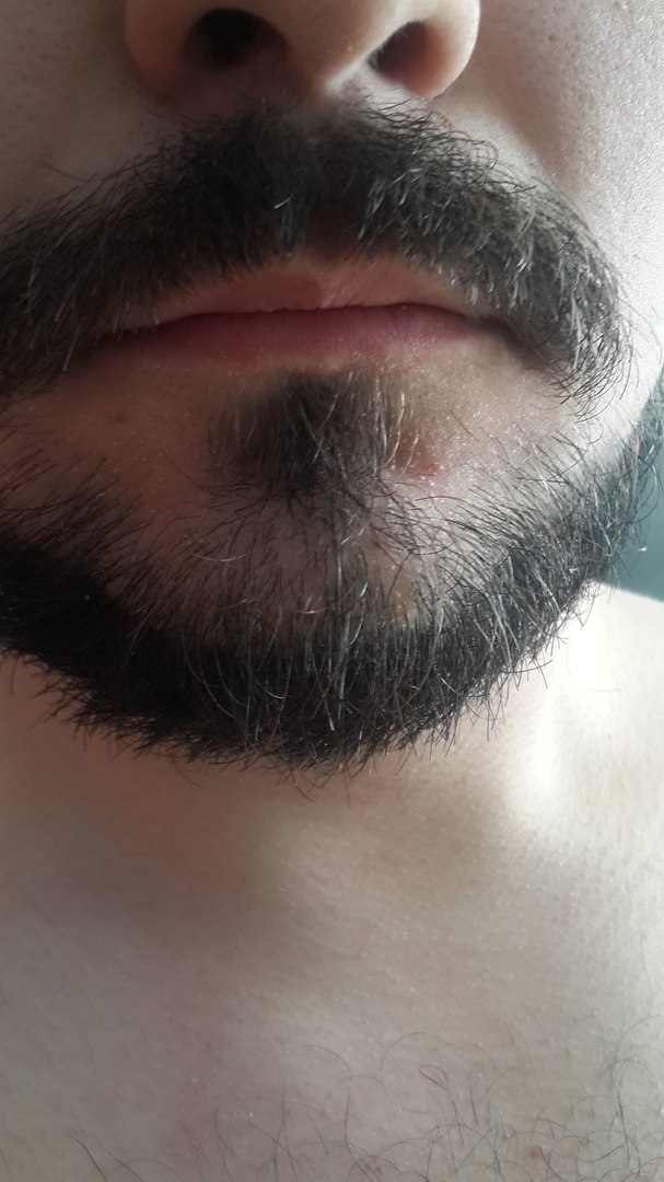 Усы с бородой. Мужские усы. Двойные усы. Плохо растут усы. Губы мужские.